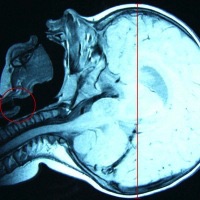 MRT Medianschnitt.jpg